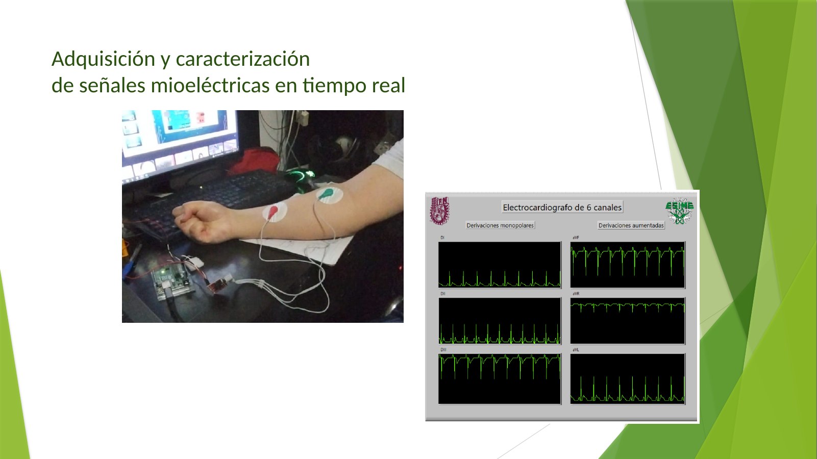Lámina 5: Adquisición y caracterización de señales mioeléctricas en tiempo real